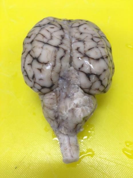 SOP: Performing a brain dissection