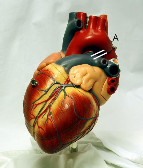 Heart dissection walk through